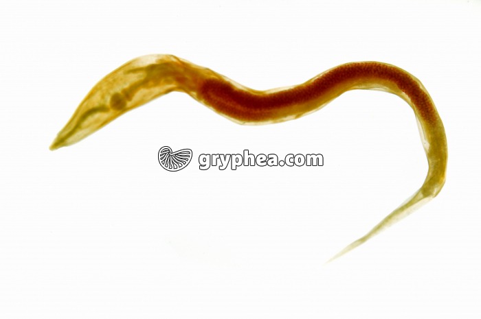 Oxyure - Ver parasite - Enterobius vermicularis femelle x7 - gryphea.org